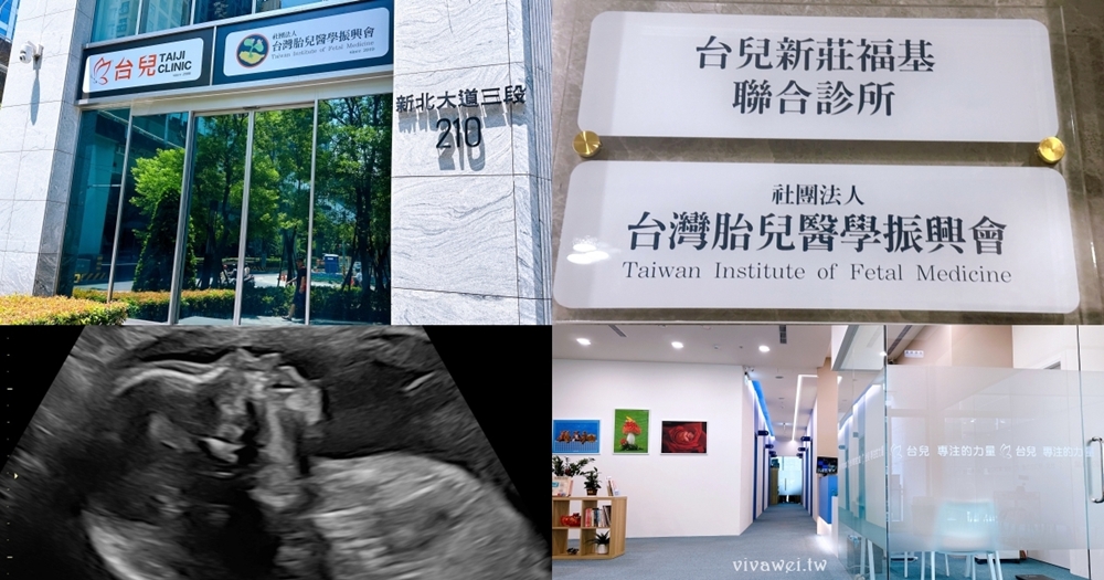 【新北新莊｜台兒醫療總部｜張東曜醫師】懷孕22-24週．中期胎檢．高層次超音波檢查（預約方式&檢查費用&檢查結果）