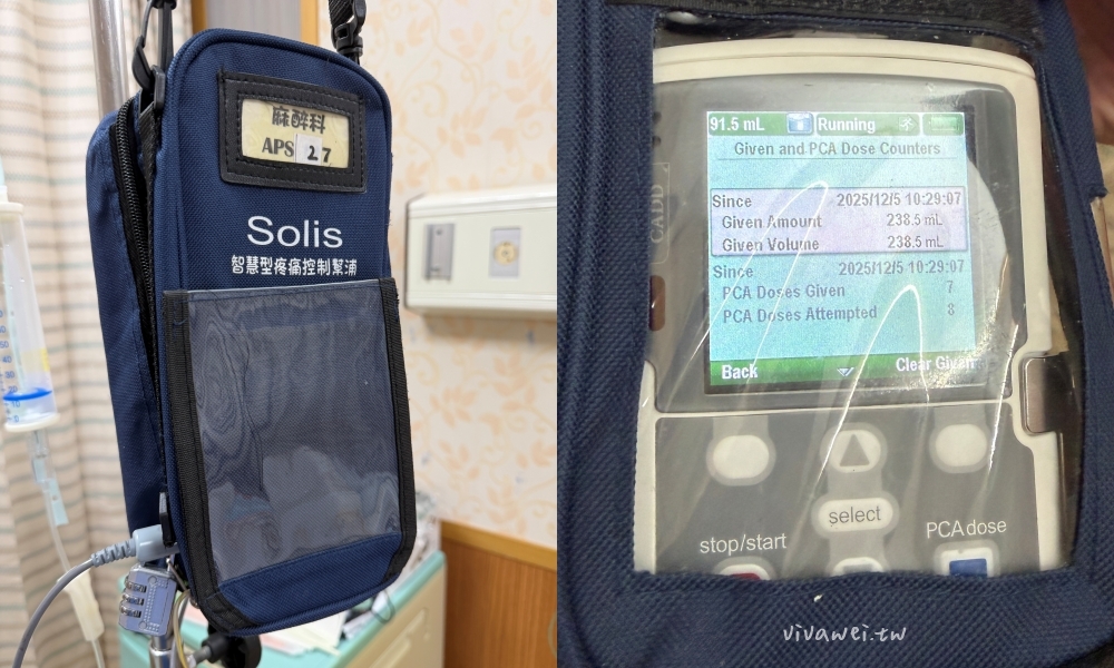 桃園醫院剖腹產紀錄＆生產費用｜38週+5天二寶湯圓報到！呂理政醫師接生～單人病房、術後止痛、產婦餐花費全紀錄！