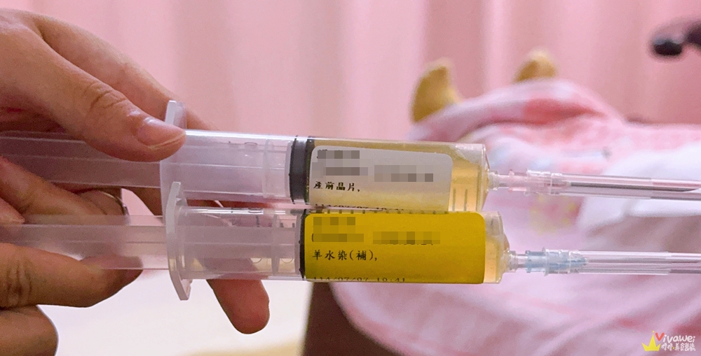 【柯滄銘婦產科診所】懷孕17週．2025年羊膜穿刺+羊水晶片檢查（檢查費用&報告等多久）