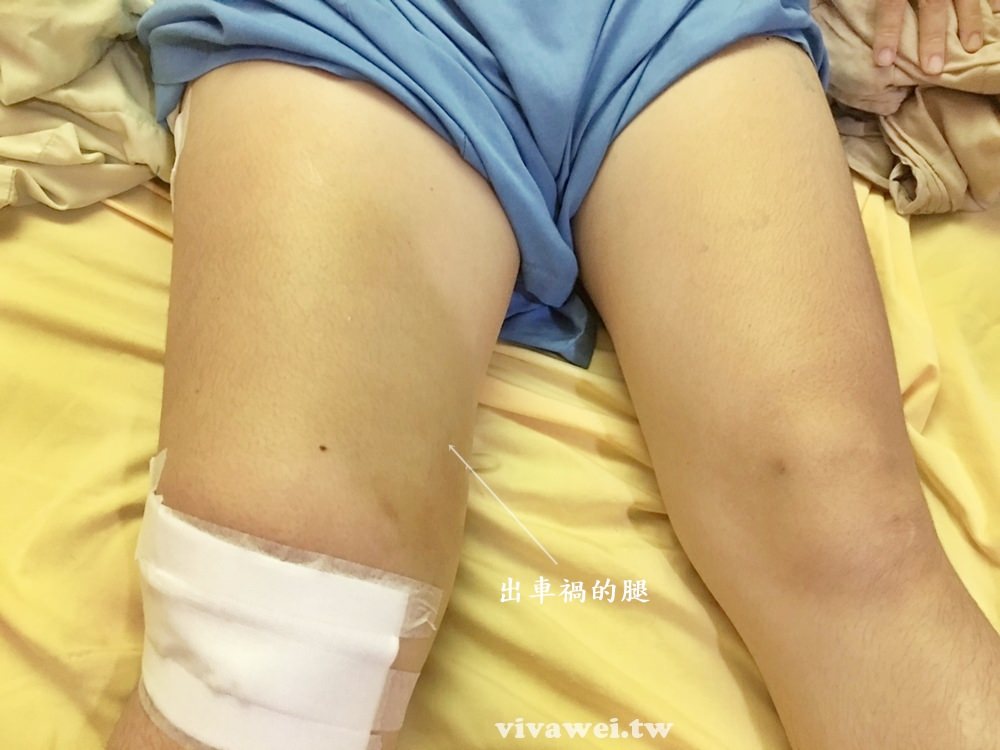 2017年車禍點滴-桃園醫院單人房住院紀錄(右大腿骨折/膝蓋縫線/全身多處瘀青)