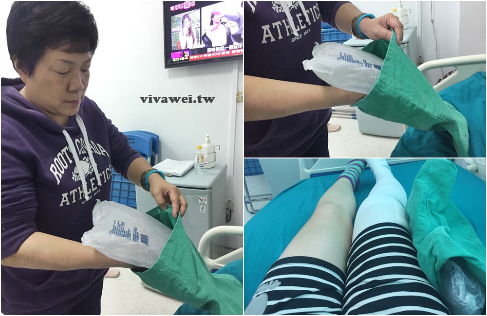 大腿骨折癒合不良需要第二次手術-苗栗弘大醫院骨科開刀&單人病房住院紀錄
