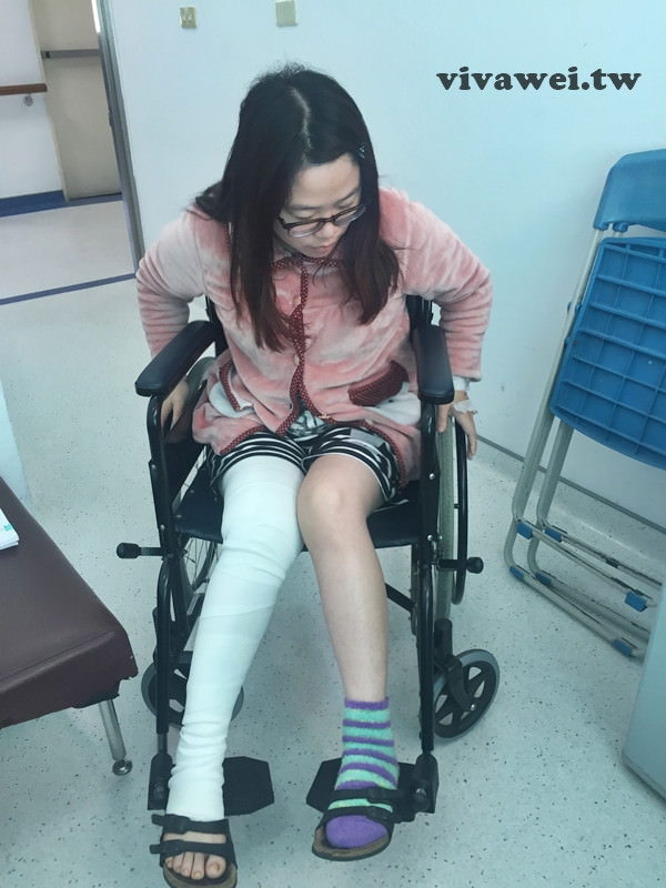 大腿骨折癒合不良需要第二次手術-苗栗弘大醫院骨科開刀&單人病房住院紀錄