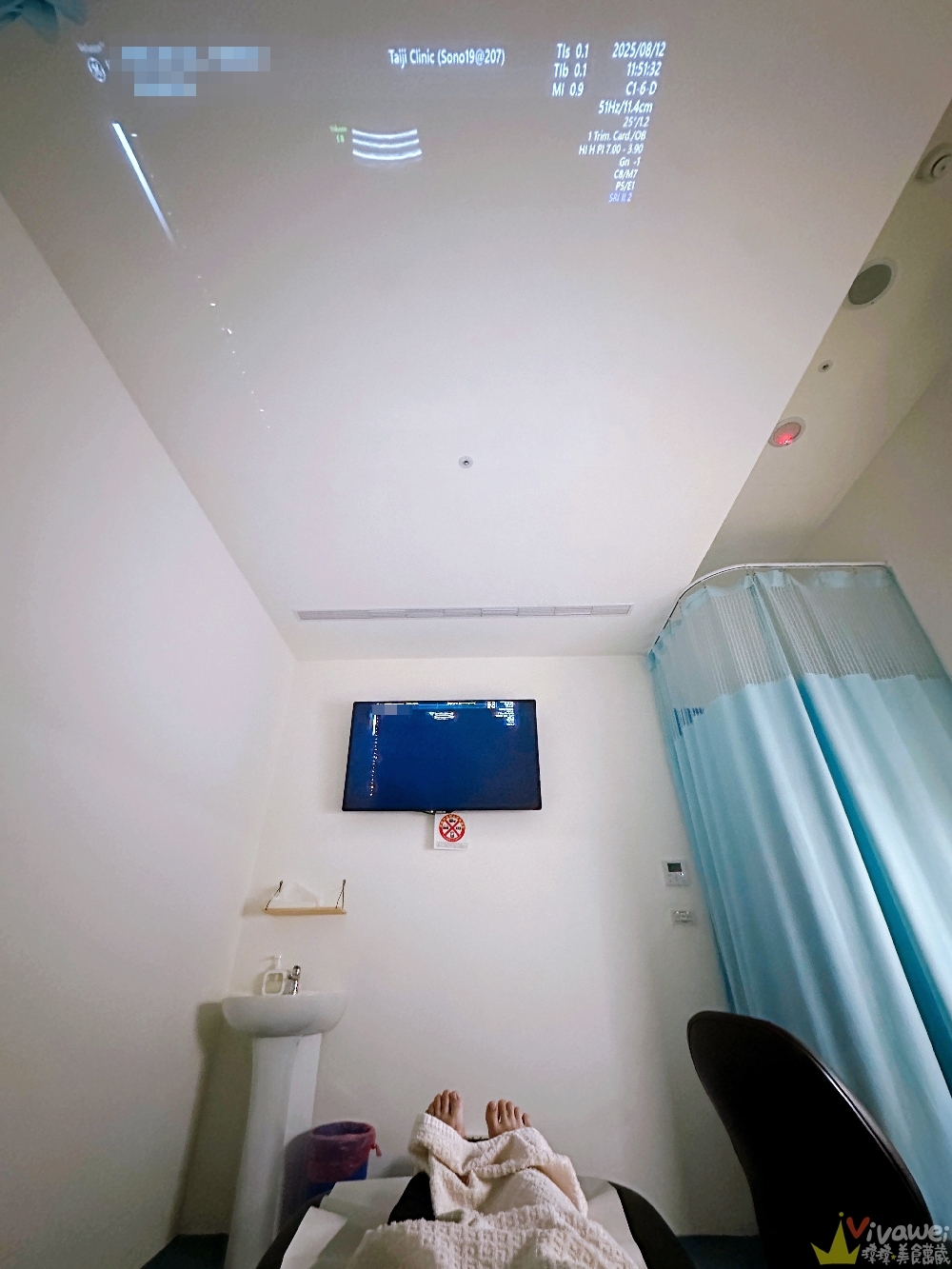 【新北新莊｜台兒醫療總部｜張東曜醫師】懷孕22-24週．中期胎檢．高層次超音波檢查（預約方式&檢查費用&檢查結果）