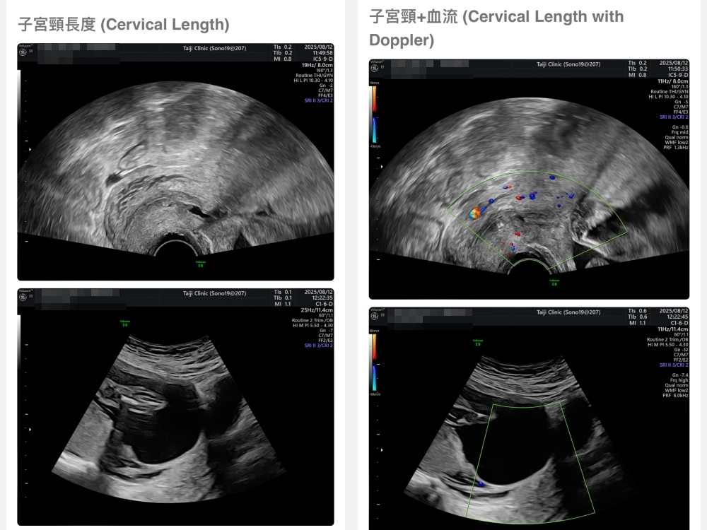【新北新莊｜台兒醫療總部｜張東曜醫師】懷孕22-24週．中期胎檢．高層次超音波檢查（預約方式&檢查費用&檢查結果）
