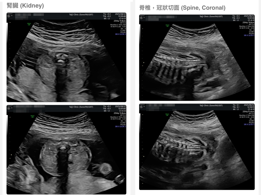 【新北新莊｜台兒醫療總部｜張東曜醫師】懷孕22-24週．中期胎檢．高層次超音波檢查（預約方式&檢查費用&檢查結果）