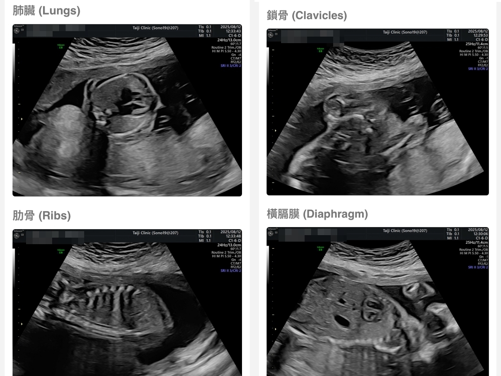 【新北新莊｜台兒醫療總部｜張東曜醫師】懷孕22-24週．中期胎檢．高層次超音波檢查（預約方式&檢查費用&檢查結果）