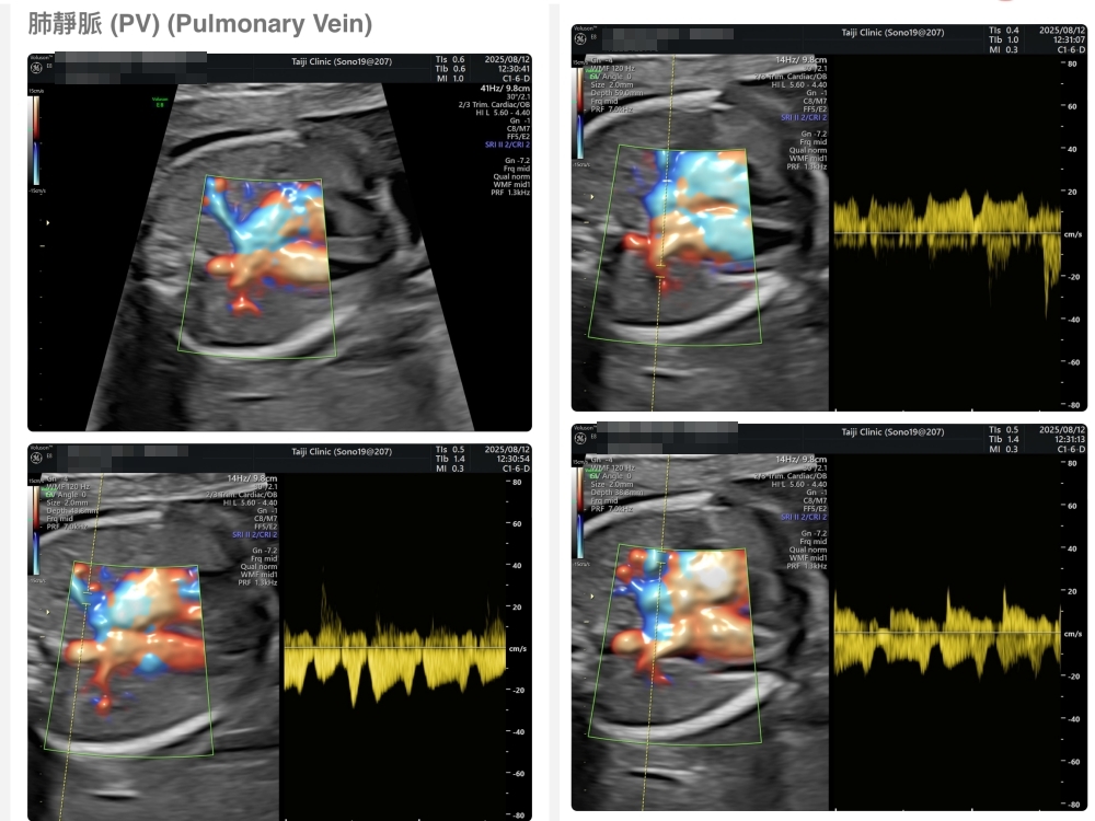 【新北新莊｜台兒醫療總部｜張東曜醫師】懷孕22-24週．中期胎檢．高層次超音波檢查（預約方式&檢查費用&檢查結果）