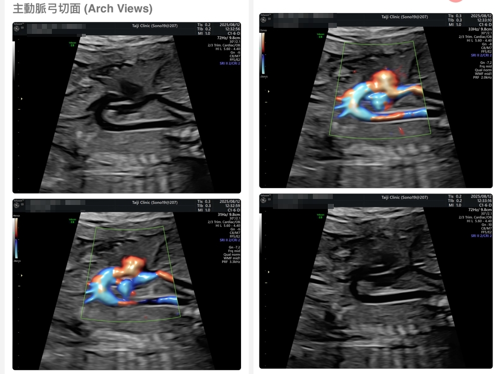 【新北新莊｜台兒醫療總部｜張東曜醫師】懷孕22-24週．中期胎檢．高層次超音波檢查（預約方式&檢查費用&檢查結果）