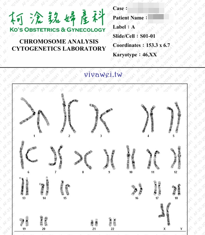 【柯滄銘婦產科診所】懷孕17週．2025年羊膜穿刺+羊水晶片檢查（檢查費用&報告等多久）